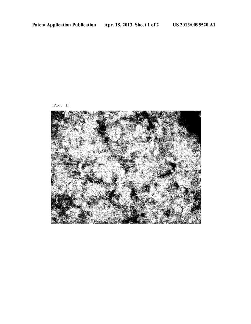 METHOD FOR DETECTION OF UROTHELIAL CANCER - diagram, schematic, and image 02