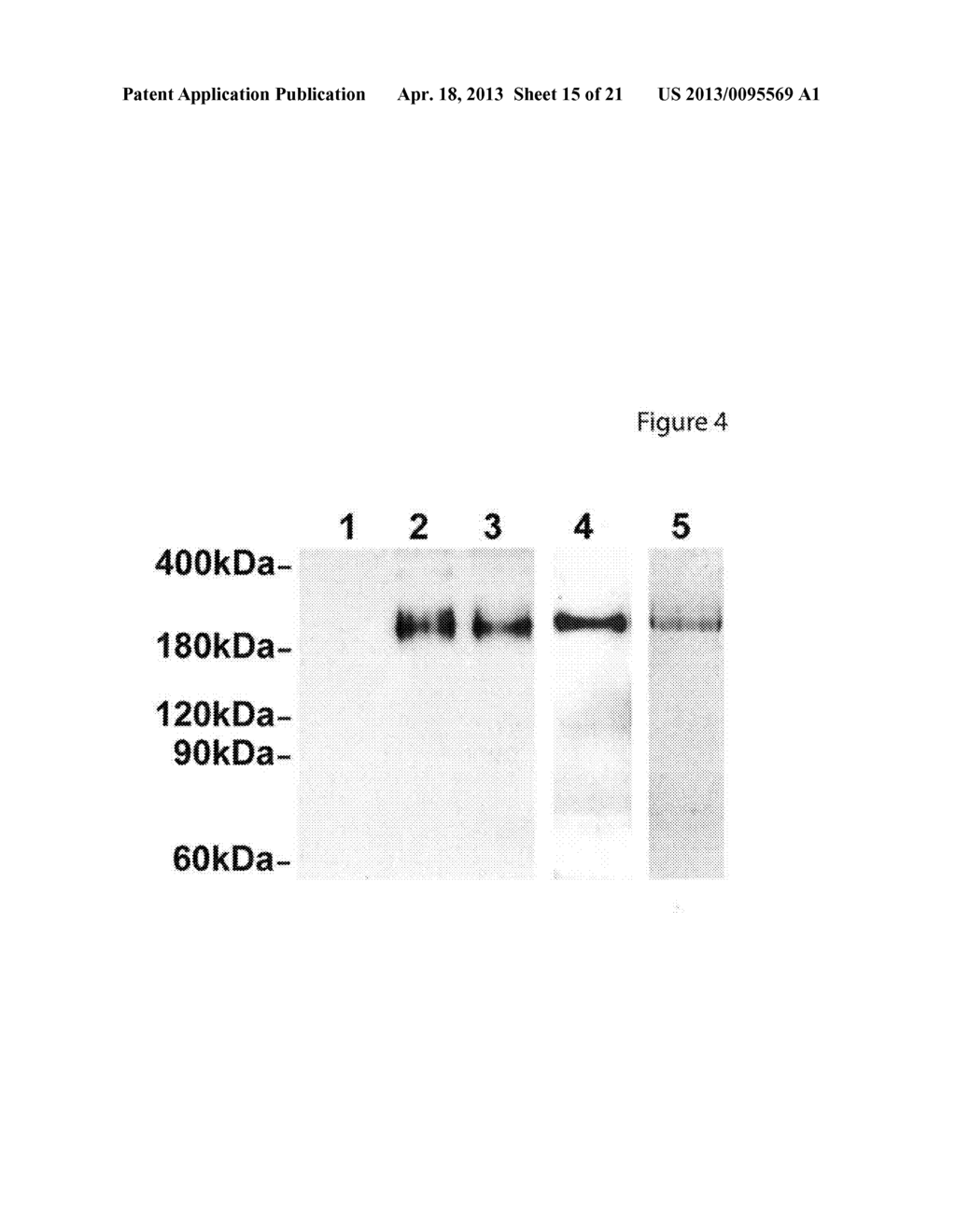 PREGNANCY-ASSOCIATED PLASMA PROTEIN-A2 (PAPP-A2) POLYNUCLEOTIDES - diagram, schematic, and image 16