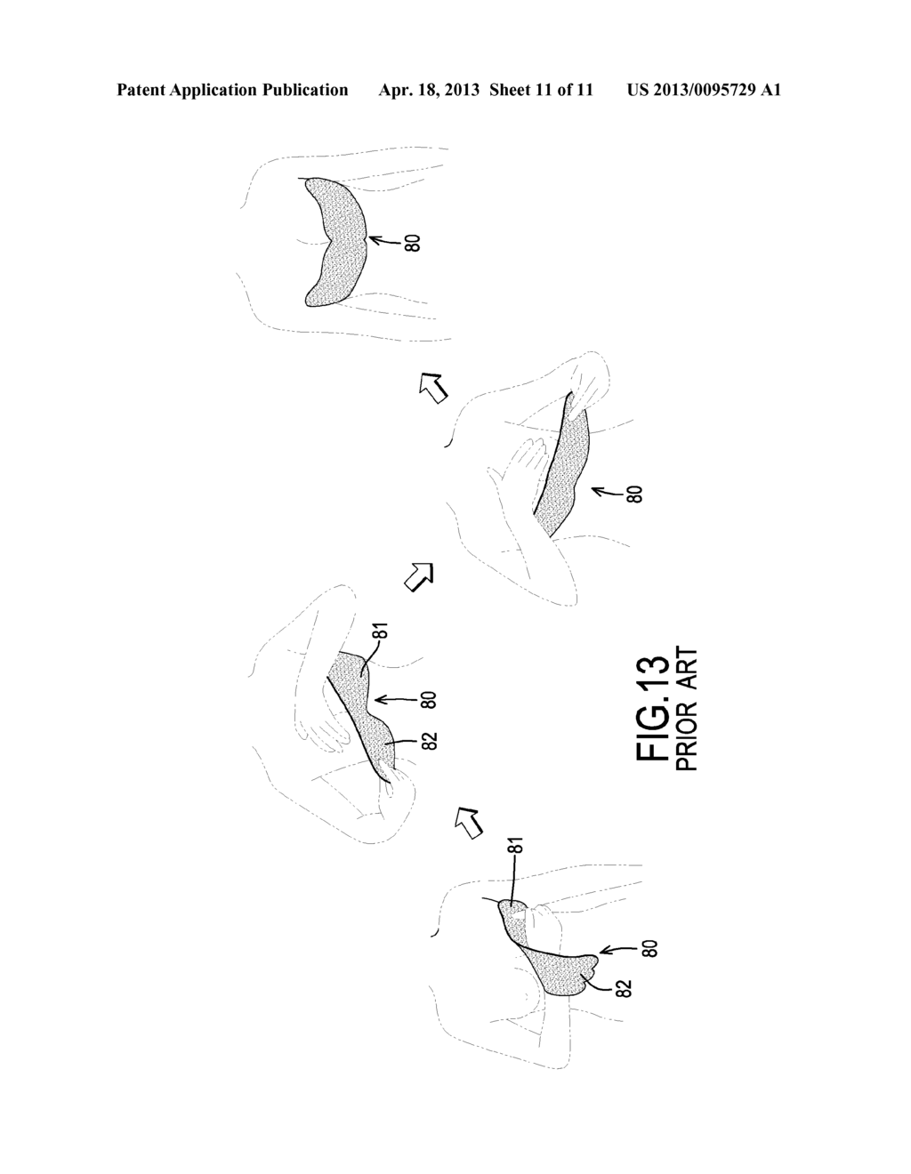 INVISIBLE BRA - diagram, schematic, and image 12