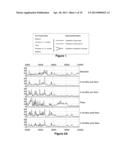 Hepcidins as Biomarkers for Impending Lupus Nephritis Flare diagram and image