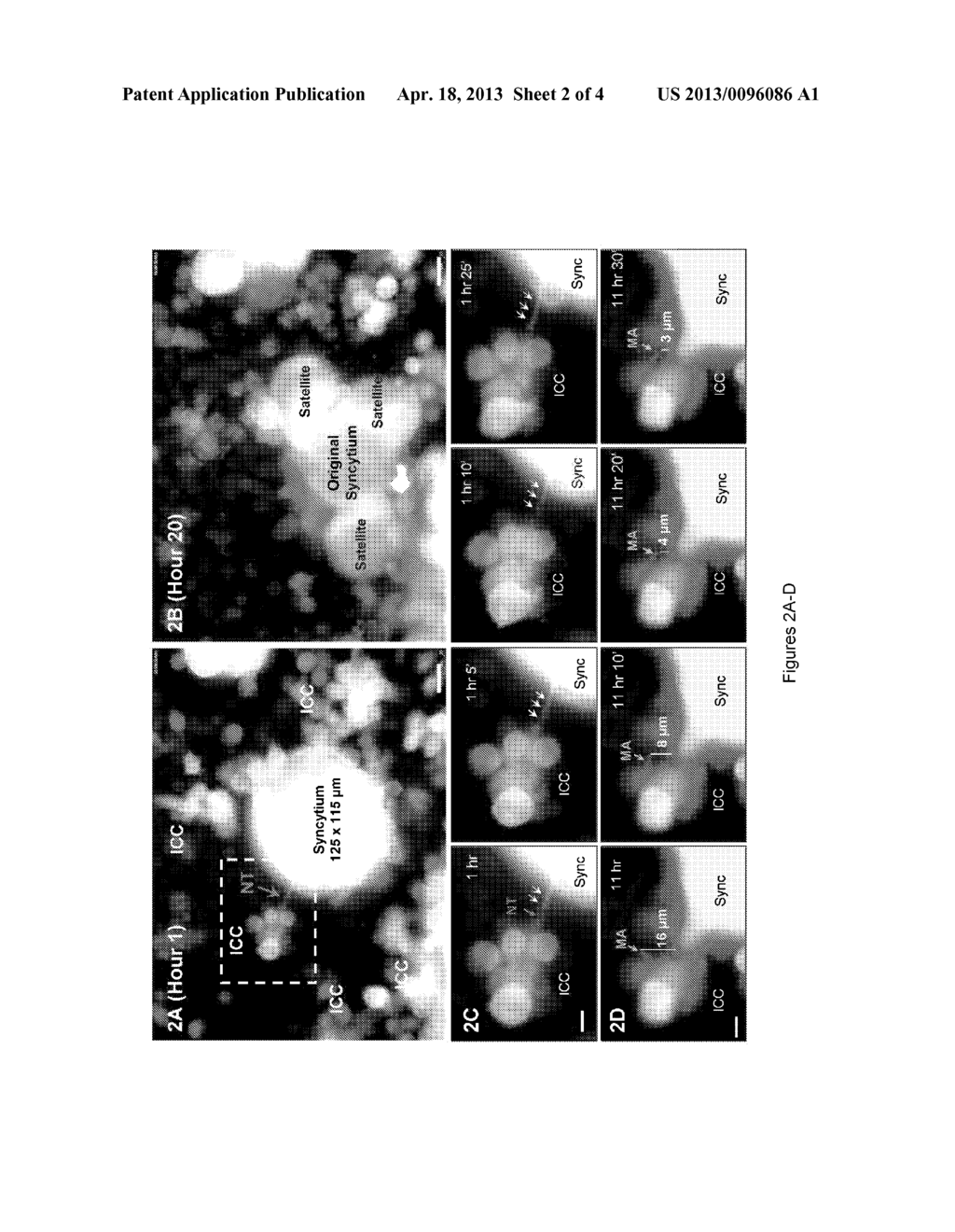 MITOCHONDRIA AND HUMAN IMMUNODEFIENCY VIRUS TYPE 1 - diagram, schematic, and image 03