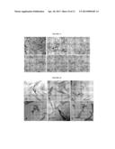 TREATMENT OF SODIUM CHANNEL, VOLTAGE-GATED, ALPHA SUBUNIT (SCNA) RELATED     DISEASES BY INHIBITION OF NATURAL ANTISENSE TRANSCRIPT TO SCNA diagram and image