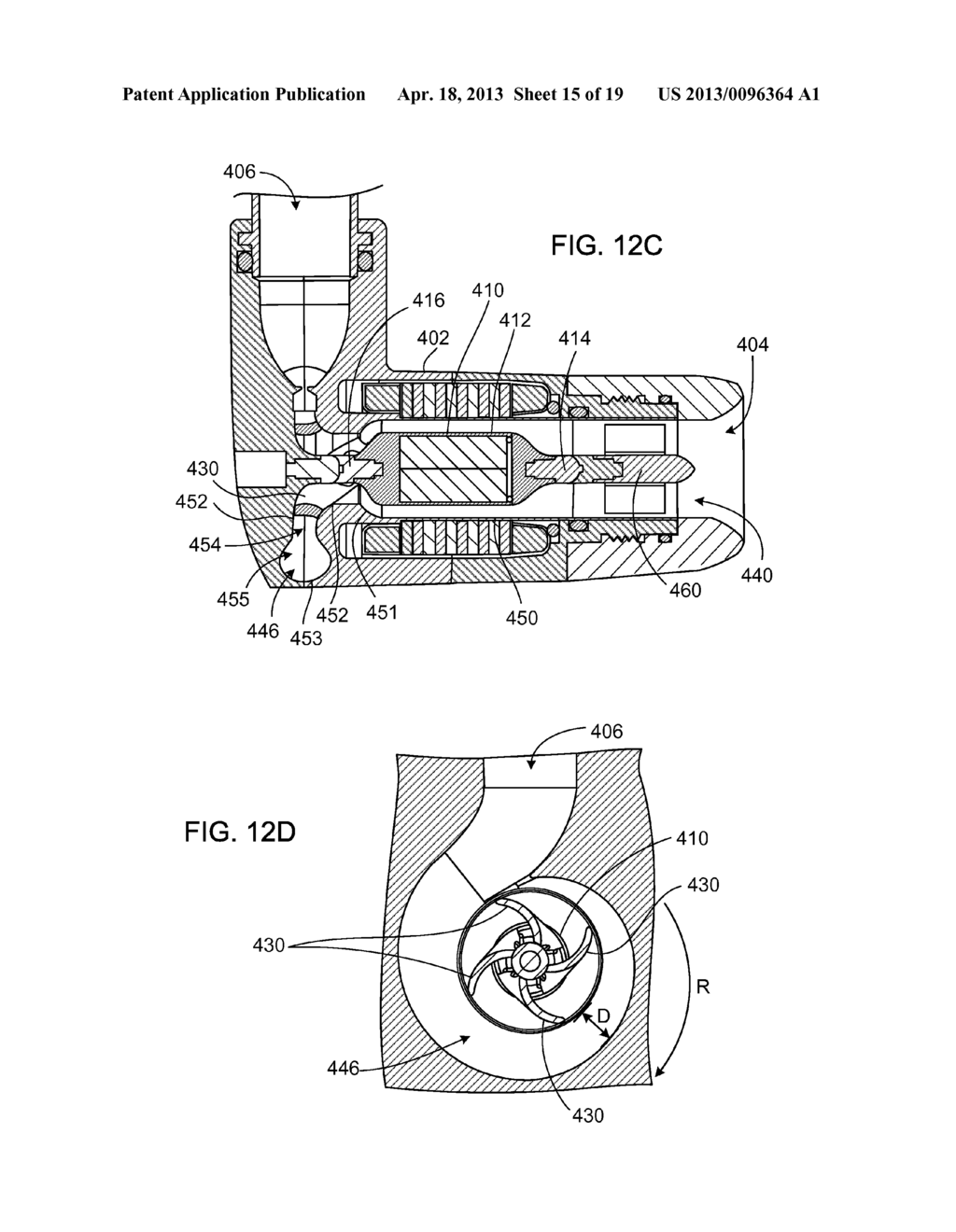 PUMP AND METHOD FOR MIXED FLOW BLOOD PUMPING - diagram, schematic, and image 16