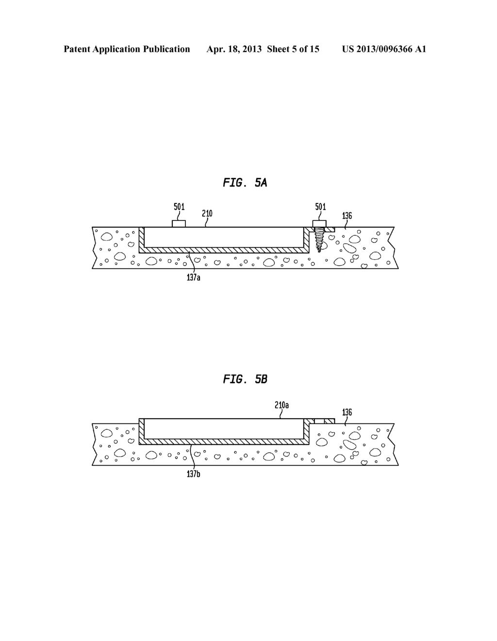 IMPLANTABLE MEDICAL DEVICE - diagram, schematic, and image 06