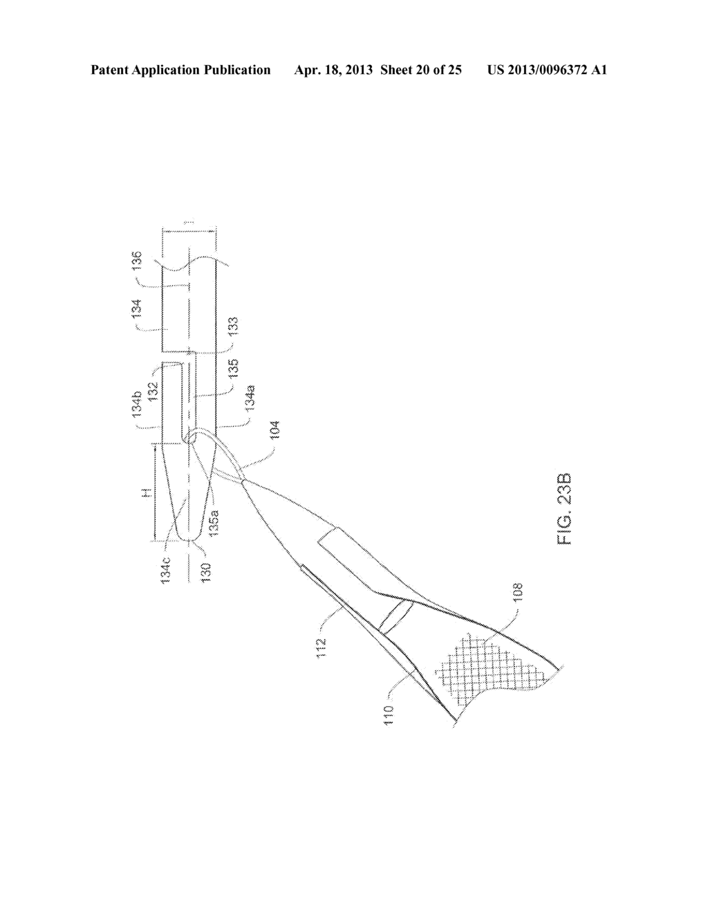 SYSTEMS AND METHODS RELATING TO ASSOCIATING A MEDICAL IMPLANT WITH A     DELIVERY DEVICE - diagram, schematic, and image 21