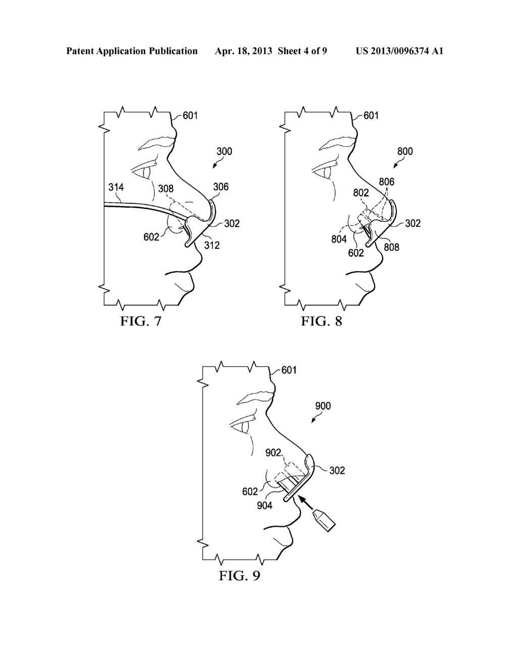 Portable Endoscope and Method of Use Thereof - diagram, schematic, and image 05