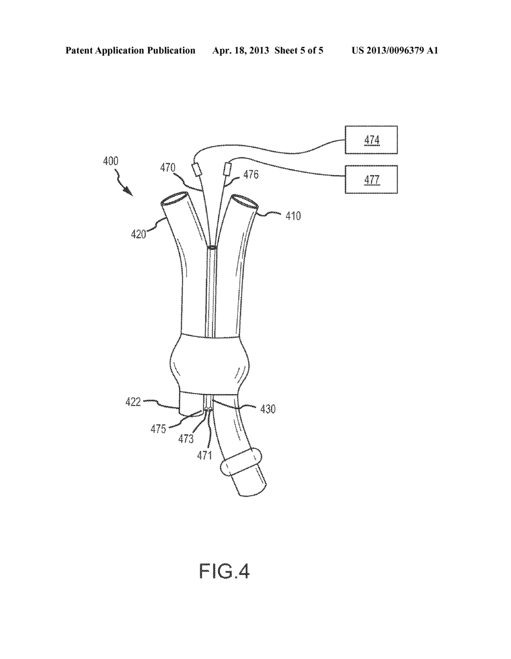 DOUBLE-LUMEN ENDOTRACHEAL TUBE DEVICES, SYSTEMS AND METHODS - diagram, schematic, and image 06