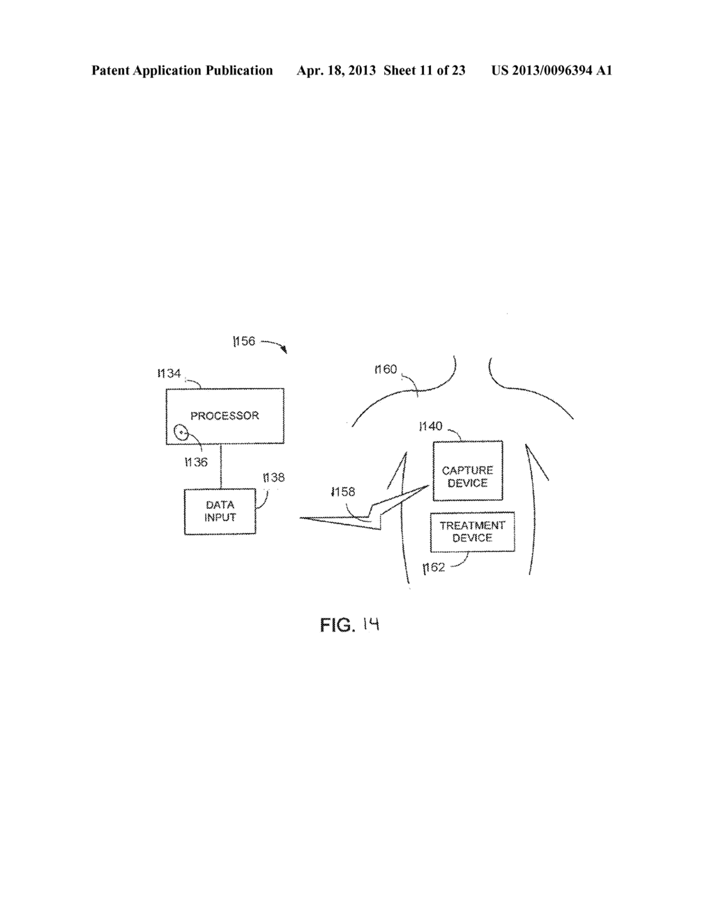 SYSTEM AND METHOD FOR EVALUATING AN ELECTROPHYSIOLOGICAL SIGNAL - diagram, schematic, and image 12