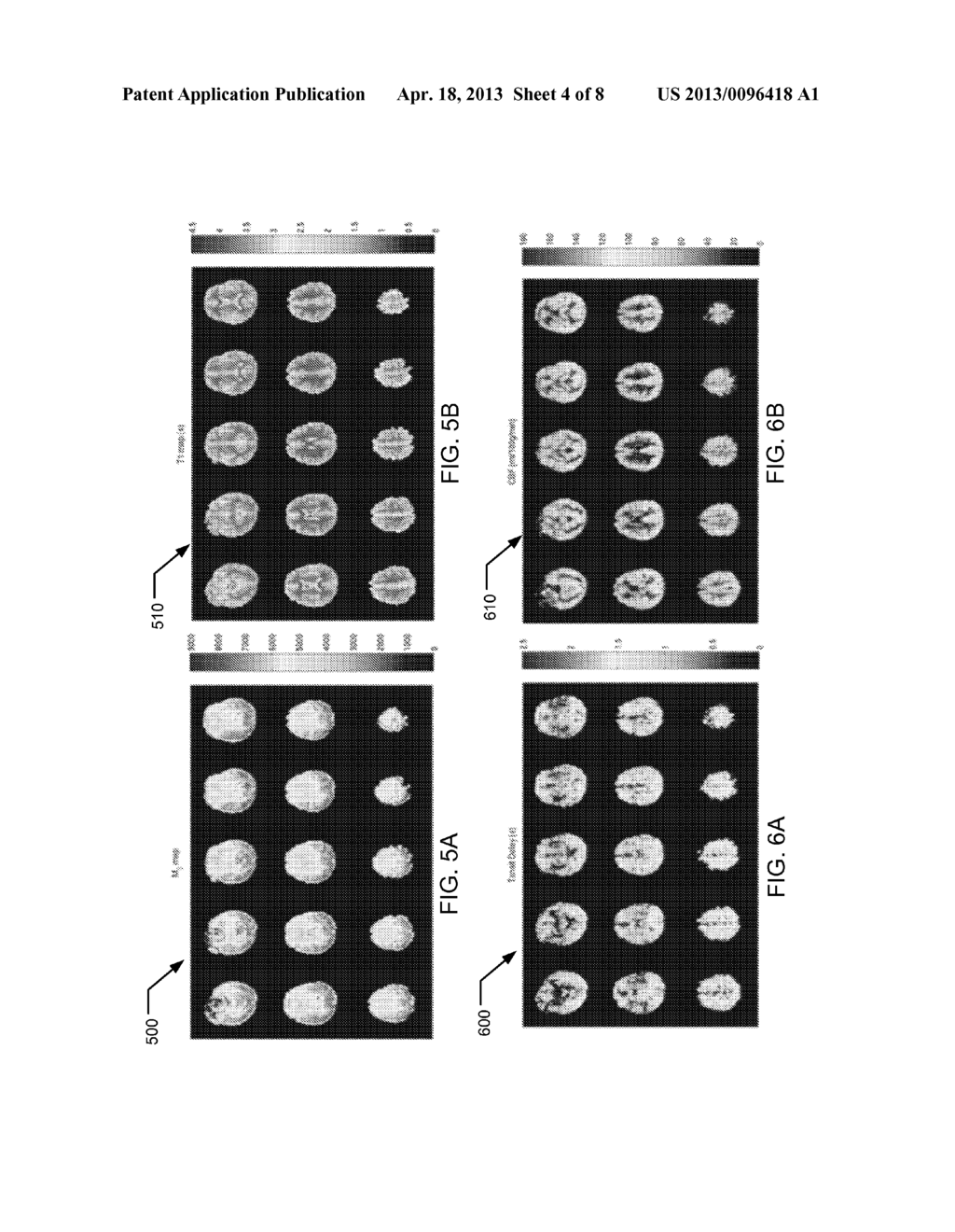 ARTERIAL BLOOD FLOW AND TRANSIT DELAY MEASUREMENT USING ARTERIAL SPIN     LABELING - diagram, schematic, and image 05