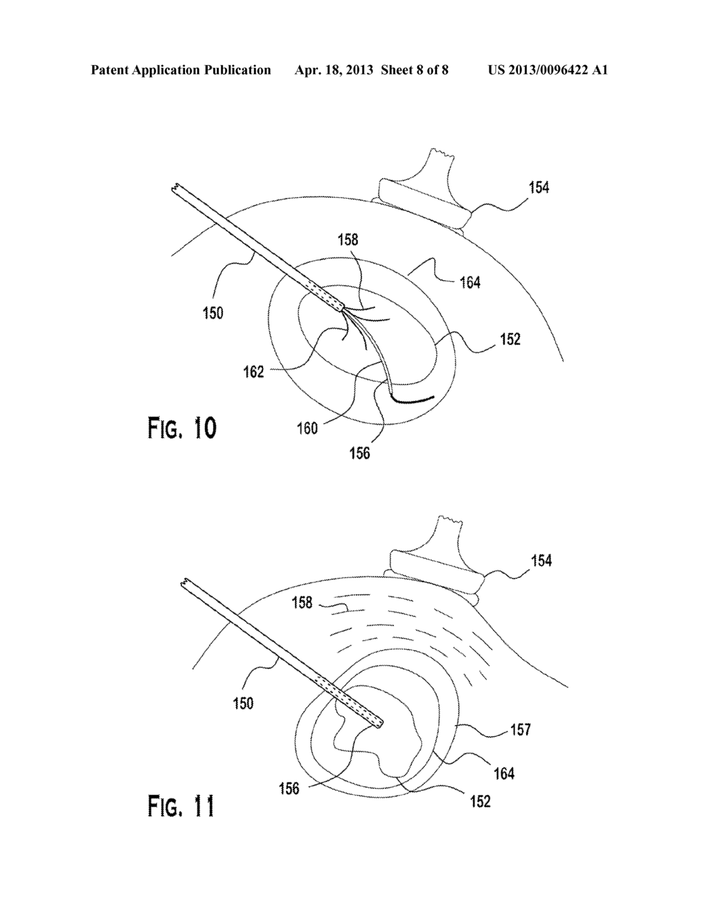 INTERVENTIONAL PHOTOACOUSTIC IMAGING SYSTEM - diagram, schematic, and image 09