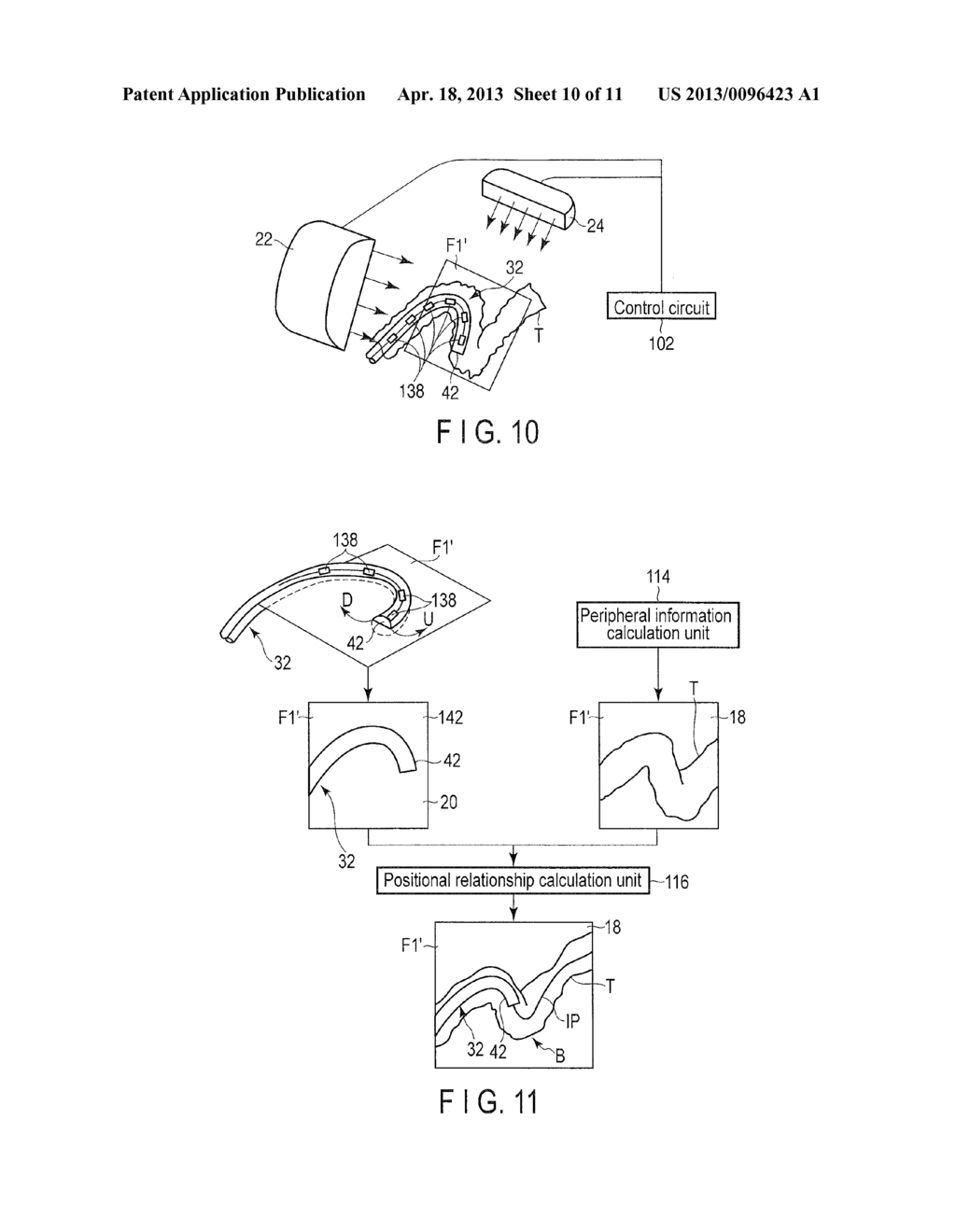 ENDOSCOPE SYSTEM - diagram, schematic, and image 11