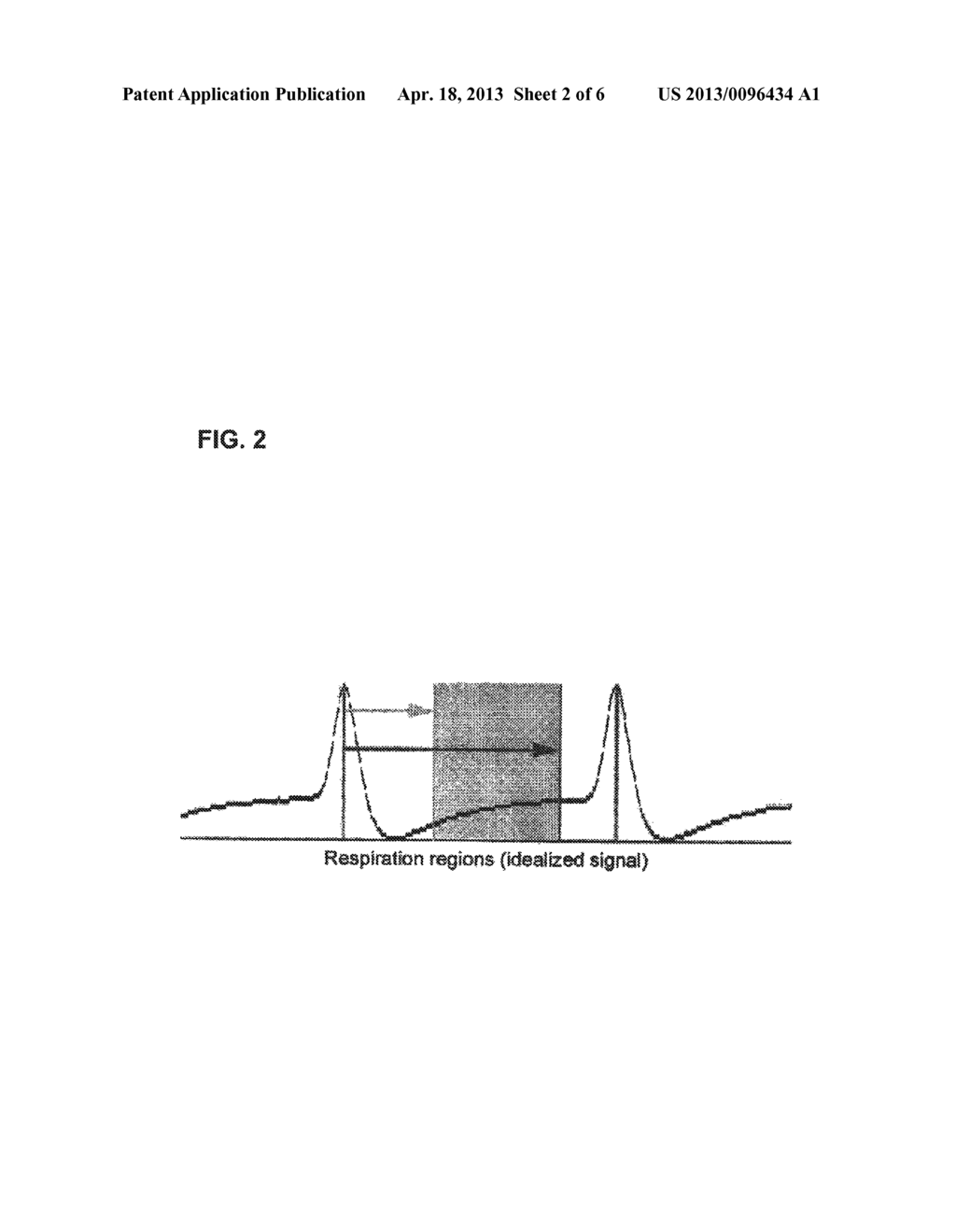 METHODS FOR ACQUISITION AND DISPLAY IN ULTRASOUND IMAGING - diagram, schematic, and image 03