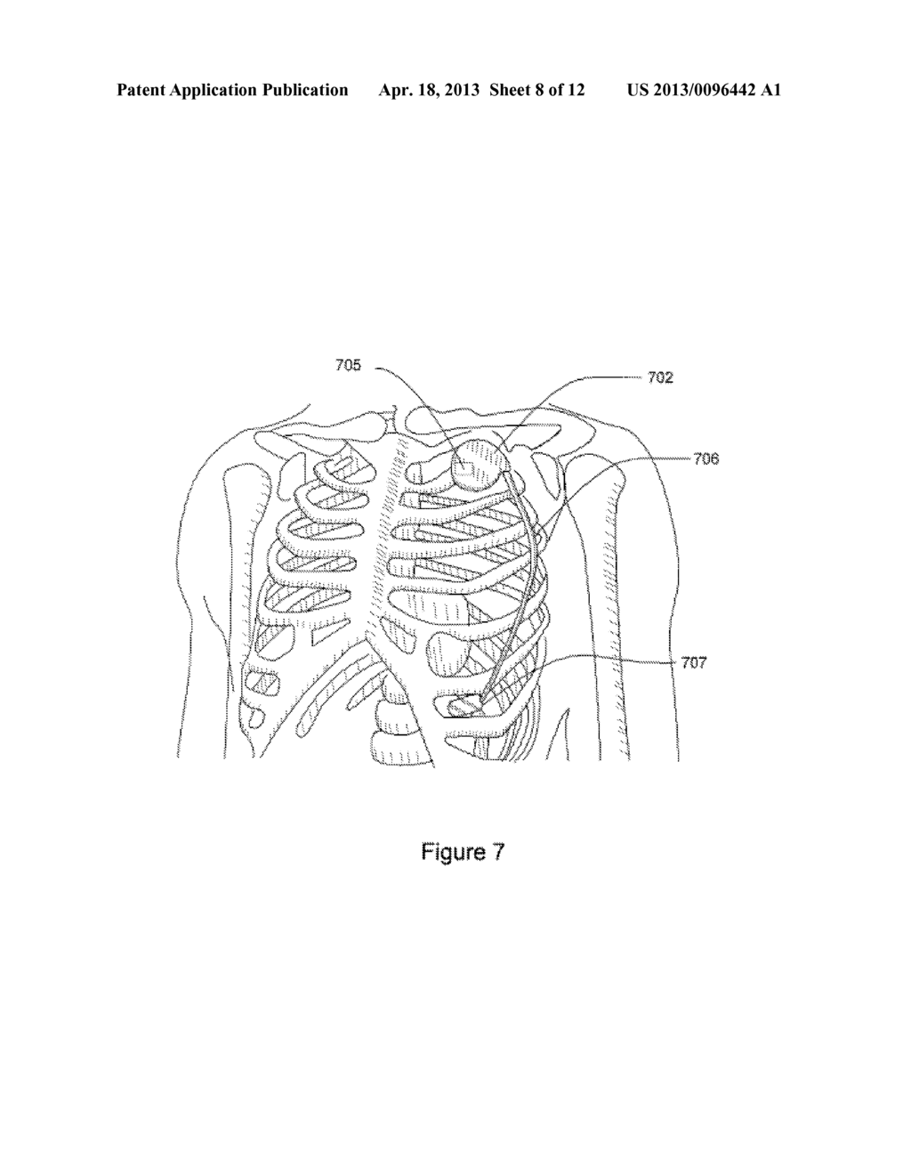 MEDICAL EVENT LOGBOOK SYSTEM AND METHOD - diagram, schematic, and image 09