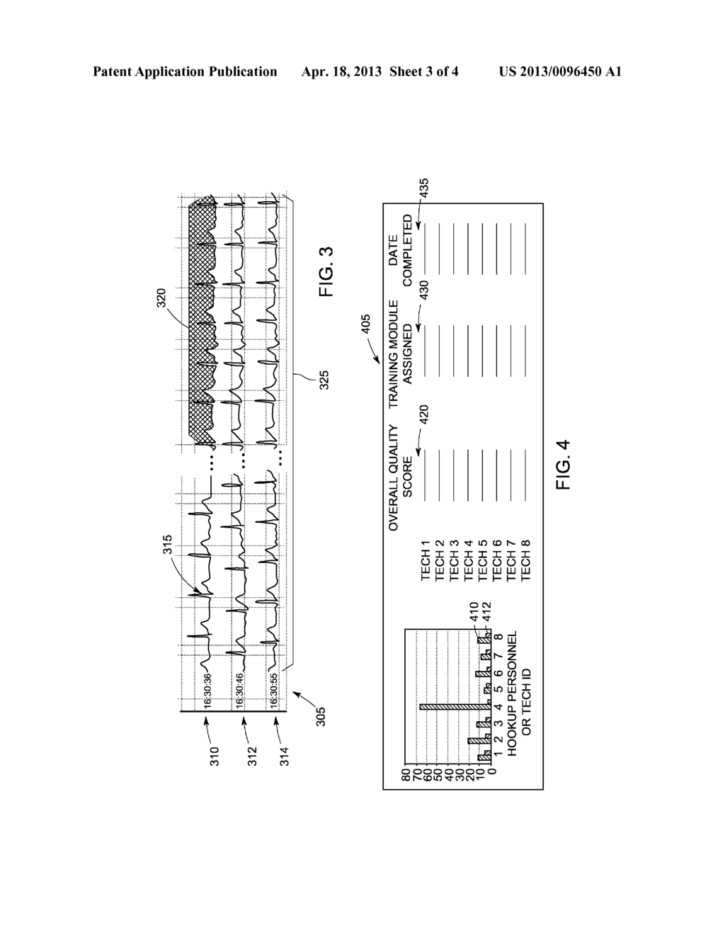 SYSTEM AND METHOD OF QUALITY ANALYSIS IN ACQUISITION OF AMBULATORY     ELECTROCARDIOGRAPHY DEVICE DATA - diagram, schematic, and image 04