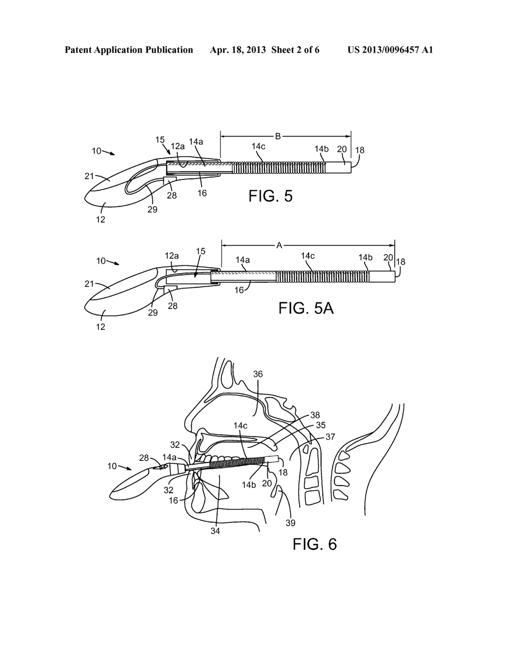 ORAL SCOPE SYSTEM WITH IMAGE SENSOR AND METHOD FOR VISUAL EXAMINATION OF     ORAL CAVITY AND UPPER AIRWAY - diagram, schematic, and image 03