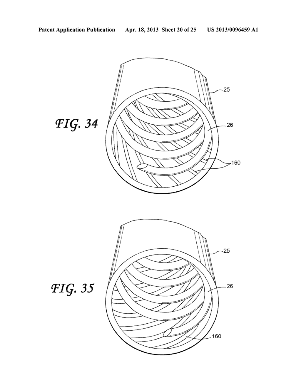 SOFT TISSUE CORING BIOPSY DEVICES AND METHODS - diagram, schematic, and image 21