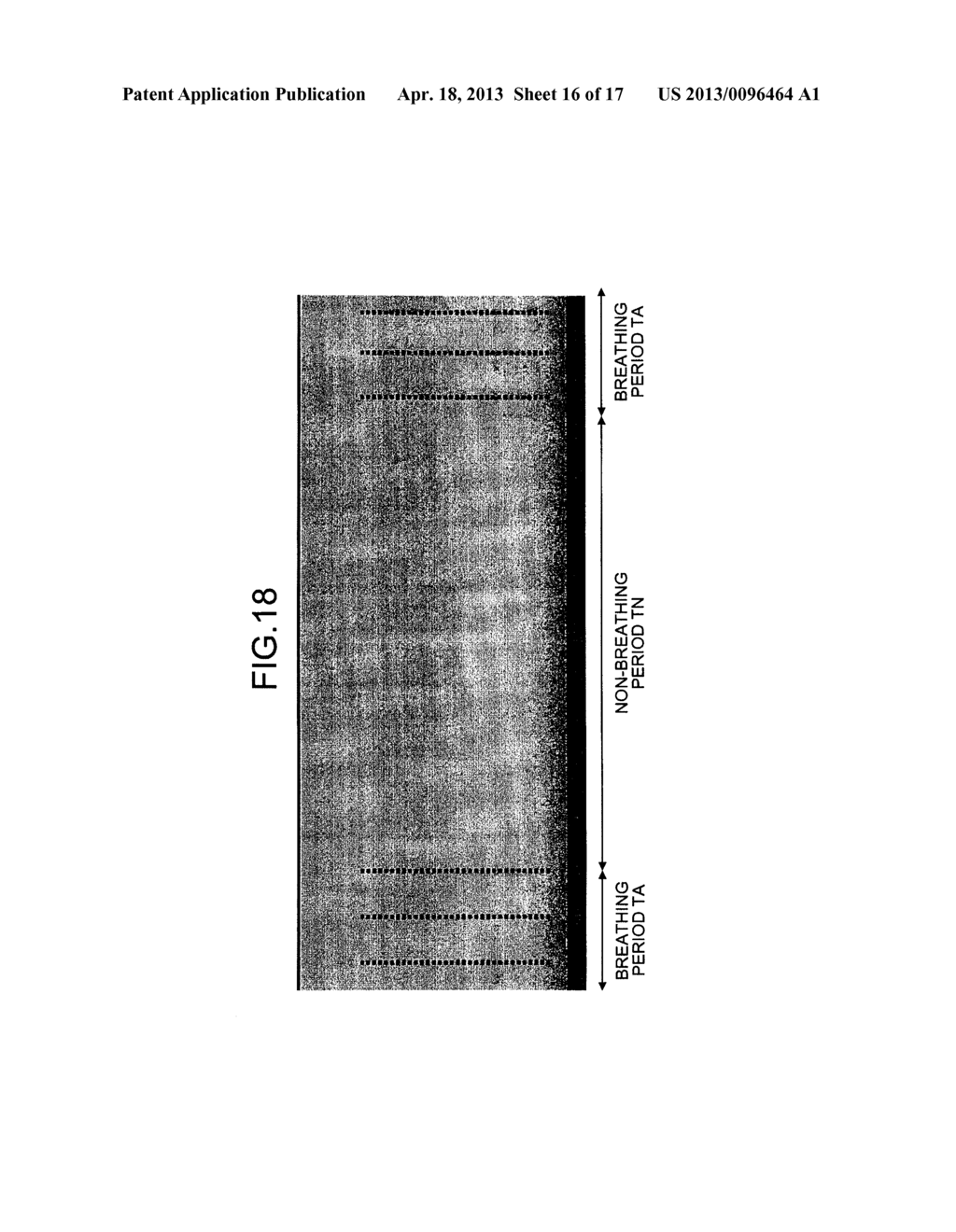 SOUND PROCESSING APPARATUS AND BREATHING DETECTION METHOD - diagram, schematic, and image 17