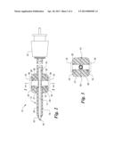 CATHETER POSITIONING SYSTEM diagram and image