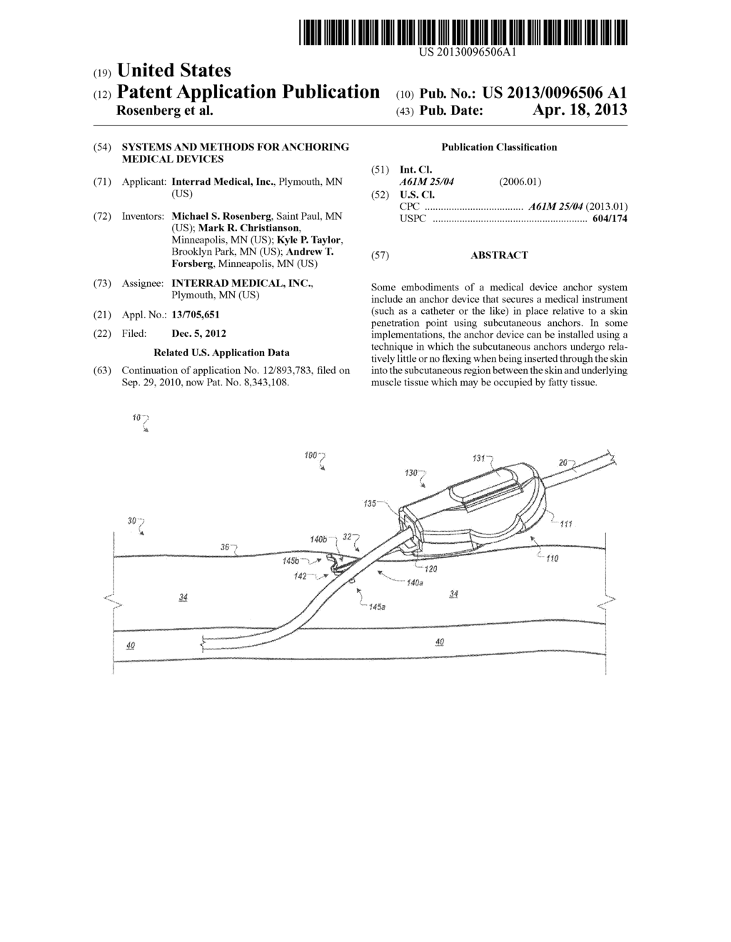 SYSTEMS AND METHODS FOR ANCHORING MEDICAL DEVICES - diagram, schematic, and image 01