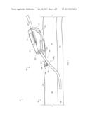 SYSTEMS AND METHODS FOR ANCHORING MEDICAL DEVICES diagram and image