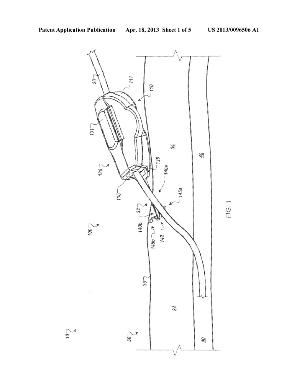 SYSTEMS AND METHODS FOR ANCHORING MEDICAL DEVICES - diagram, schematic, and image 02