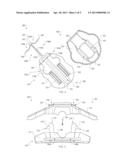 SYSTEMS AND METHODS FOR ANCHORING MEDICAL DEVICES diagram and image