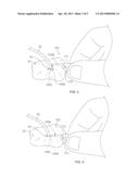 SYSTEMS AND METHODS FOR ANCHORING MEDICAL DEVICES diagram and image