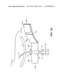 MEDICAL APPLIANCE SECURING DEVICE AND METHOD OF USING THE SAME diagram and image