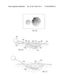 WOUND FILLING APPARATUSES AND METHODS diagram and image