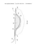 WOUND FILLING APPARATUSES AND METHODS diagram and image