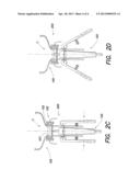 TUBE SET INSERTION APPARATUS diagram and image