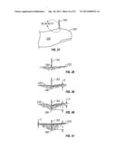 Tissue penetration device diagram and image