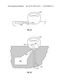 Tissue penetration device diagram and image