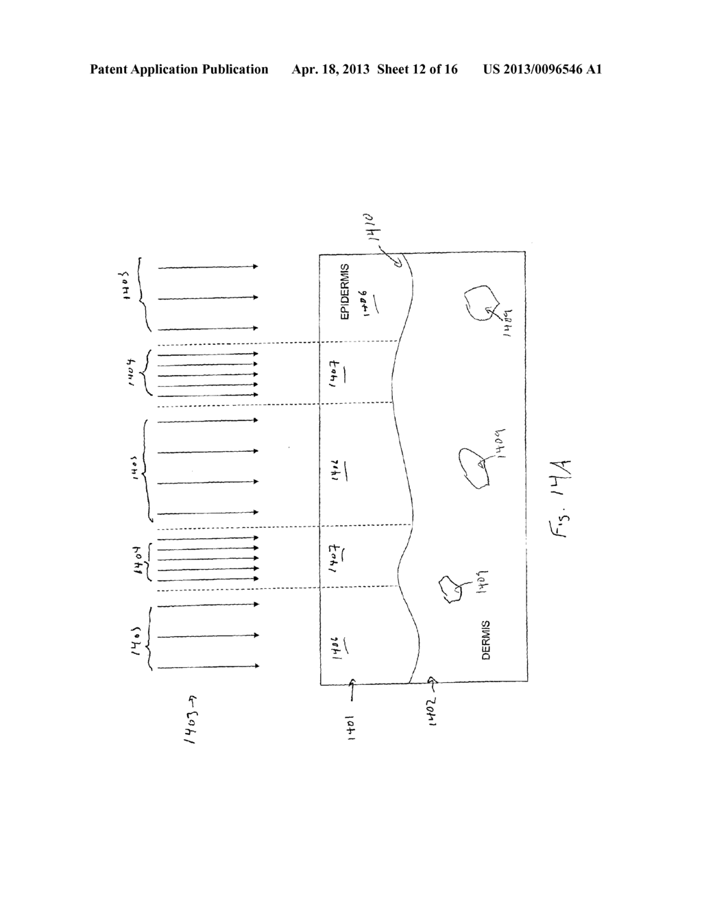 NON-UNIFORM BEAM OPTICAL TREATMENT METHODS AND SYSTEMS - diagram, schematic, and image 13