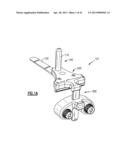 TOTAL JOINT INSTRUMENTATION AND METHOD FOR USE diagram and image