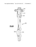 TOTAL JOINT INSTRUMENTATION AND METHOD FOR USE diagram and image