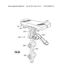 TOTAL JOINT INSTRUMENTATION AND METHOD FOR USE diagram and image