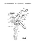 TOTAL JOINT INSTRUMENTATION AND METHOD FOR USE diagram and image