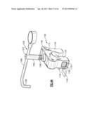 TOTAL JOINT INSTRUMENTATION AND METHOD FOR USE diagram and image