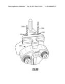 TOTAL JOINT INSTRUMENTATION AND METHOD FOR USE diagram and image