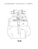 TOTAL JOINT INSTRUMENTATION AND METHOD FOR USE diagram and image