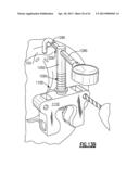 TOTAL JOINT INSTRUMENTATION AND METHOD FOR USE diagram and image