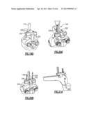 TOTAL JOINT INSTRUMENTATION AND METHOD FOR USE diagram and image