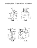 TOTAL JOINT INSTRUMENTATION AND METHOD FOR USE diagram and image