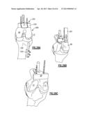 TOTAL JOINT INSTRUMENTATION AND METHOD FOR USE diagram and image