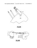 TOTAL JOINT INSTRUMENTATION AND METHOD FOR USE diagram and image