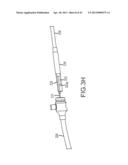 OVER-THE-WIRE CARDIAC IMPLANT DELIVERY SYSTEM FOR TREATMENT OF CHF AND     OTHER CONDITIONS diagram and image