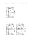 OVER-THE-WIRE CARDIAC IMPLANT DELIVERY SYSTEM FOR TREATMENT OF CHF AND     OTHER CONDITIONS diagram and image