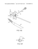 OVER-THE-WIRE CARDIAC IMPLANT DELIVERY SYSTEM FOR TREATMENT OF CHF AND     OTHER CONDITIONS diagram and image