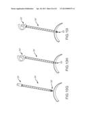 OVER-THE-WIRE CARDIAC IMPLANT DELIVERY SYSTEM FOR TREATMENT OF CHF AND     OTHER CONDITIONS diagram and image